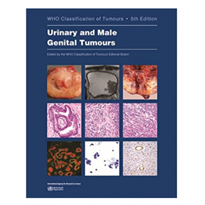 WHO's Classification of Tumours: Breast Tumours; 5th Edition 2019